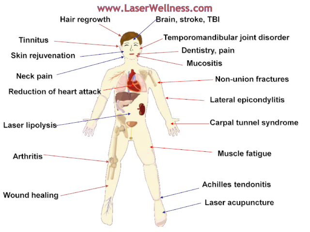 Benefits of Laser Therapy